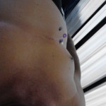 Moxabustion Honolulu Hawaii