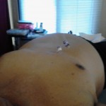 Moxabustion Honolulu Hawaii