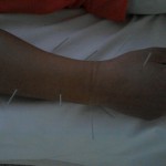 Acupuncture Arts Chinese Medicine Clinic Honolulu Hawaii