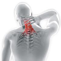 Acupuncture for Neck Pain