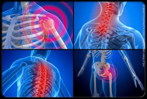 Fibromyalgia and Acupuncture