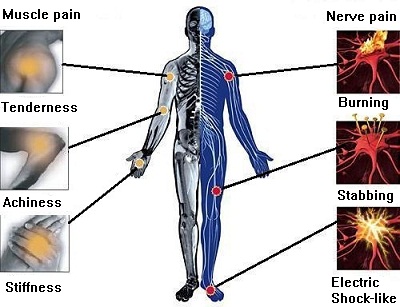 Pain Diagram