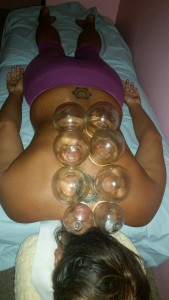 Fire_Cupping_Honolulu_Hawaii_Oahu_4